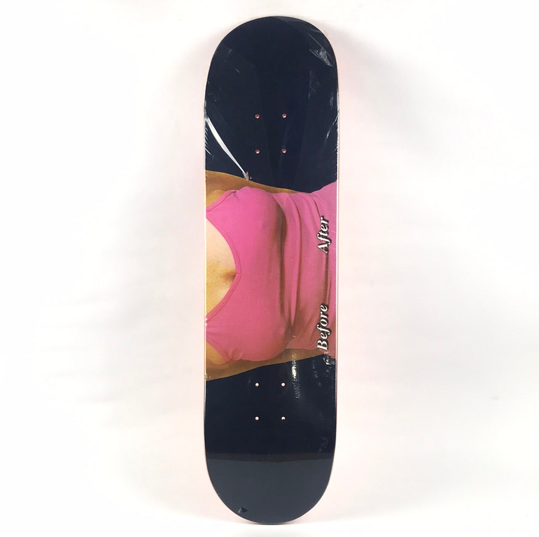Skate Mental Team Before After Blue/Pink 8.5'' Skateboard Deck
